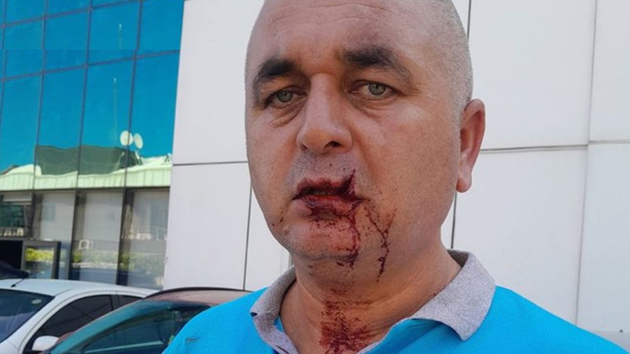 Hatalı park eden sürücü belediye işçilerine muşta ile saldırdı