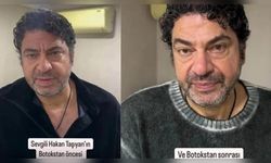 Hakan Taşıyan, Estetik Ameliyatla Yeniden Doğdu