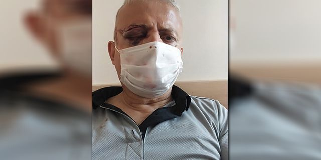 İstanbul'da metrobüste güvenlik görevlisine maske saldırısı!