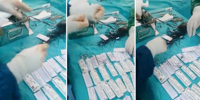 Adıyaman'da sağlık skandalı: Ameliyatta dikiş ipleri çürük çıktı