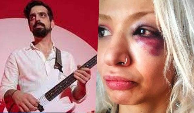 Gitarist Can Tunaboylu'nun sevgilisini dövdü iddiası