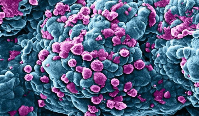 Nobel Ödüllü Bilim İnsanı, Kanserin Temel Nedenini Açıkladı