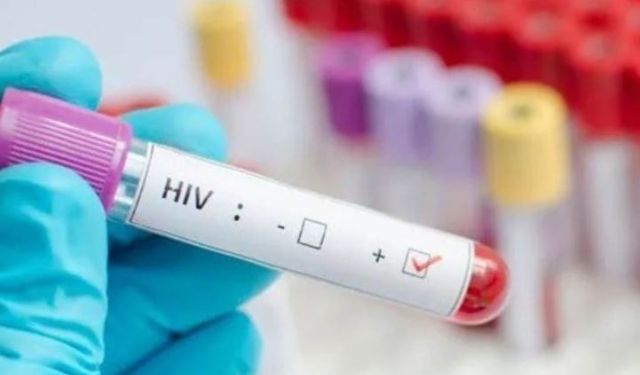 AIDS'ten ölen çocuk hakkında İl Sağlık Müdürlüğü'nden açıklama geldi