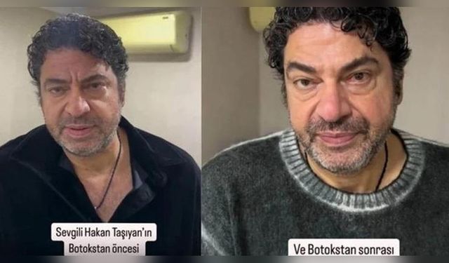 Hakan Taşıyan, Estetik Ameliyatla Yeniden Doğdu