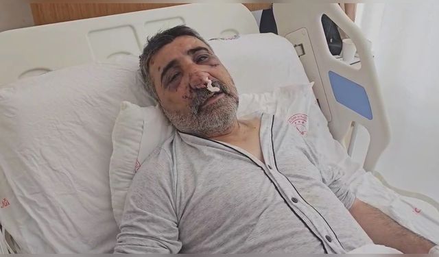 İngiliz Boksörün Saldırısına Uğrayan Taksici Olayı Anlattı