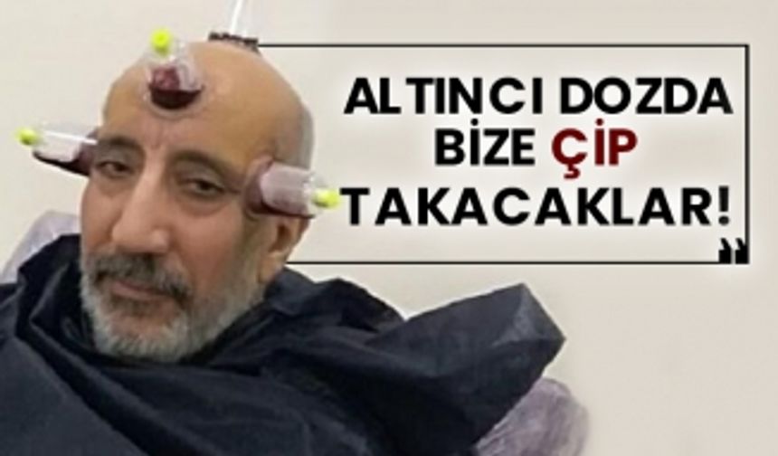 Abdurrahman Dilipak: Altıncı dozda bize çip takacaklar!