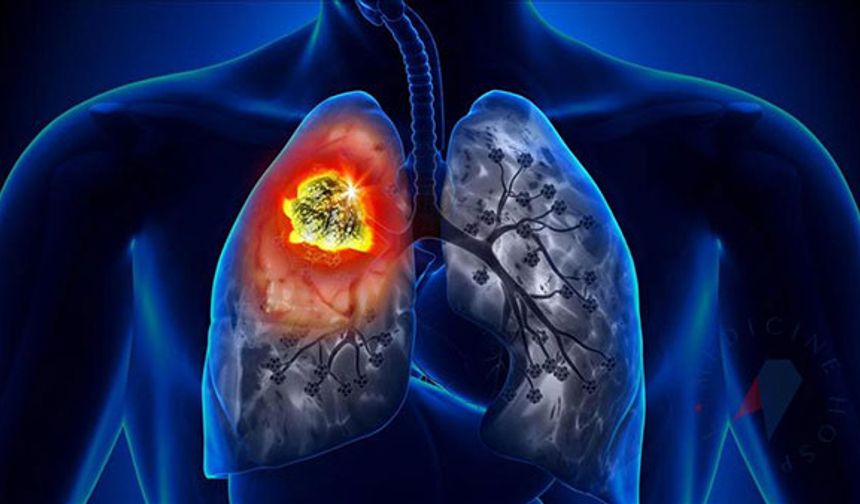 Akciğer kanseri riski artıyor