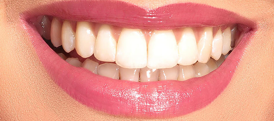 Dişlerimizin sağlıklı olması kadar, temiz ve bembeyaz dişlere sahip olmak herkesin arzusudur. Çocuk yaşlardan itibaren, vitamin eksiklikleri, yanlış fırçalama teknikleri gibi sebepler yüzünden dişlerimiz sararır ve bunun düzeltilmesi de uzman desteği olmadan zordur. 
